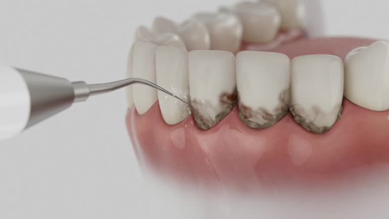 Reliable Teeth Cleaning And Checkup contractor in Waco, TX by Smile Center Dentistry